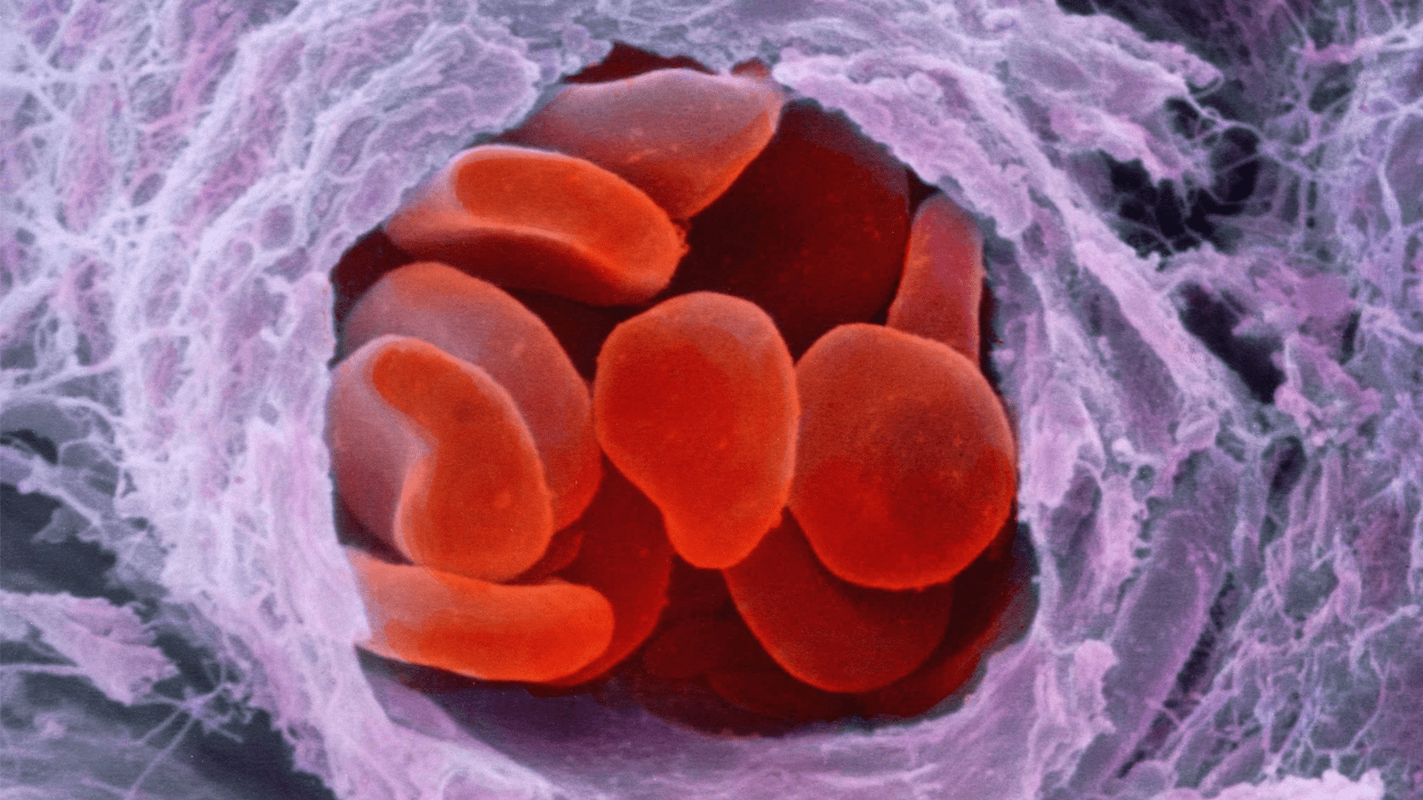 Microscopic image of Red blood cells. A group of red blood cells travelling through an arteriole, which is a small branch of an artery.