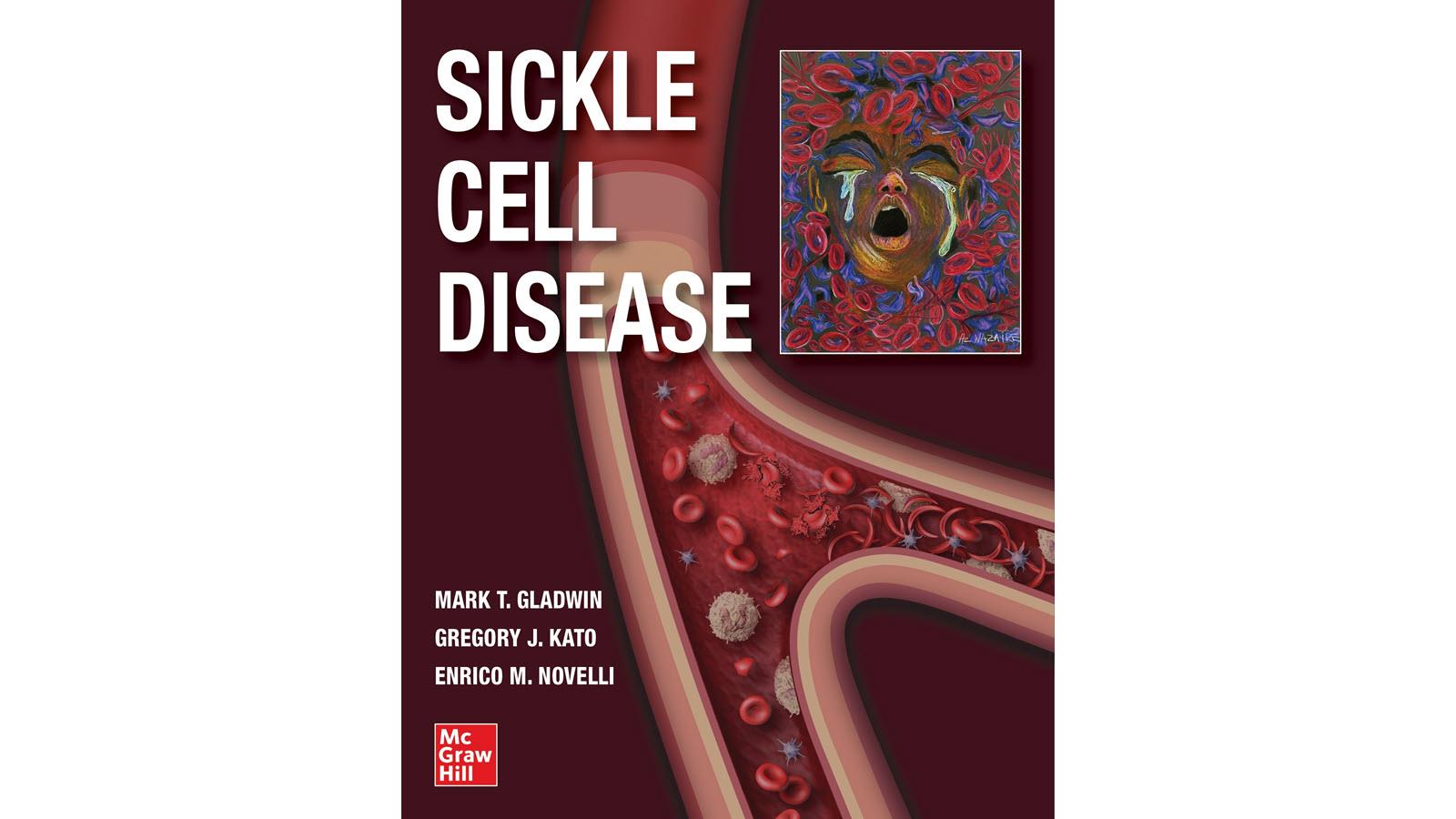 Book cover for a sickle cell disease text book with sickle-shaped blood cells and an illustration of a patient in pain