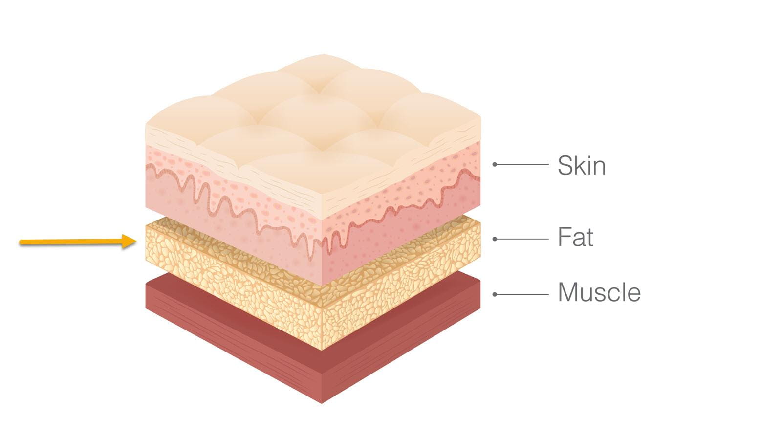 Cross section showing three layers: skin, fat and muscle