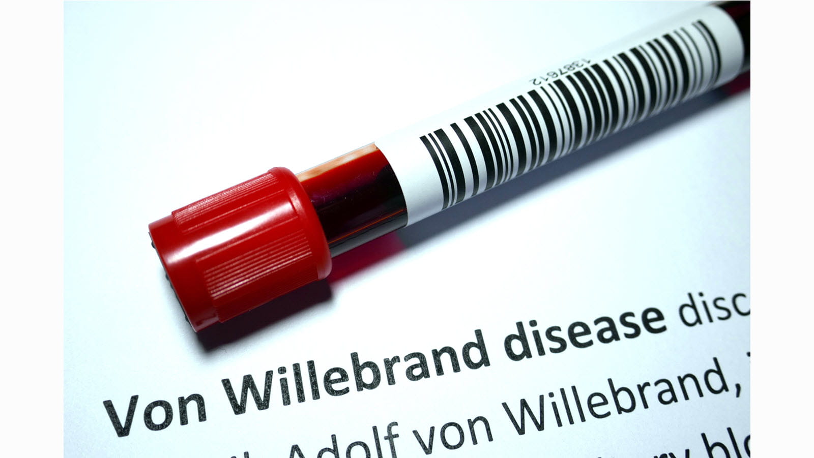 How Common Is Von Willebrand Disease?
