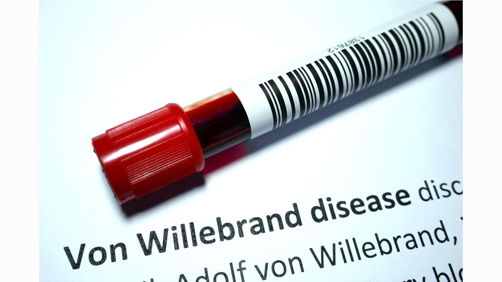 Blood sample - von Willebrand Disease